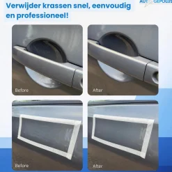 Krasverwijderaar Pro Set - Polijstset - 10 Delig